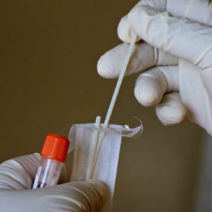 COVID-19检测试验结果